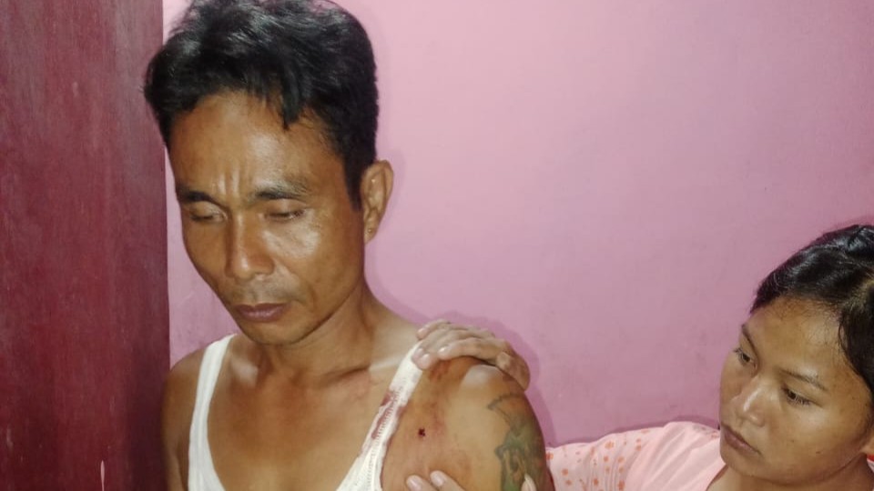 Polsek Pulau Rupat Diminta Segera Tangkap Pelaku Pengeroyokan